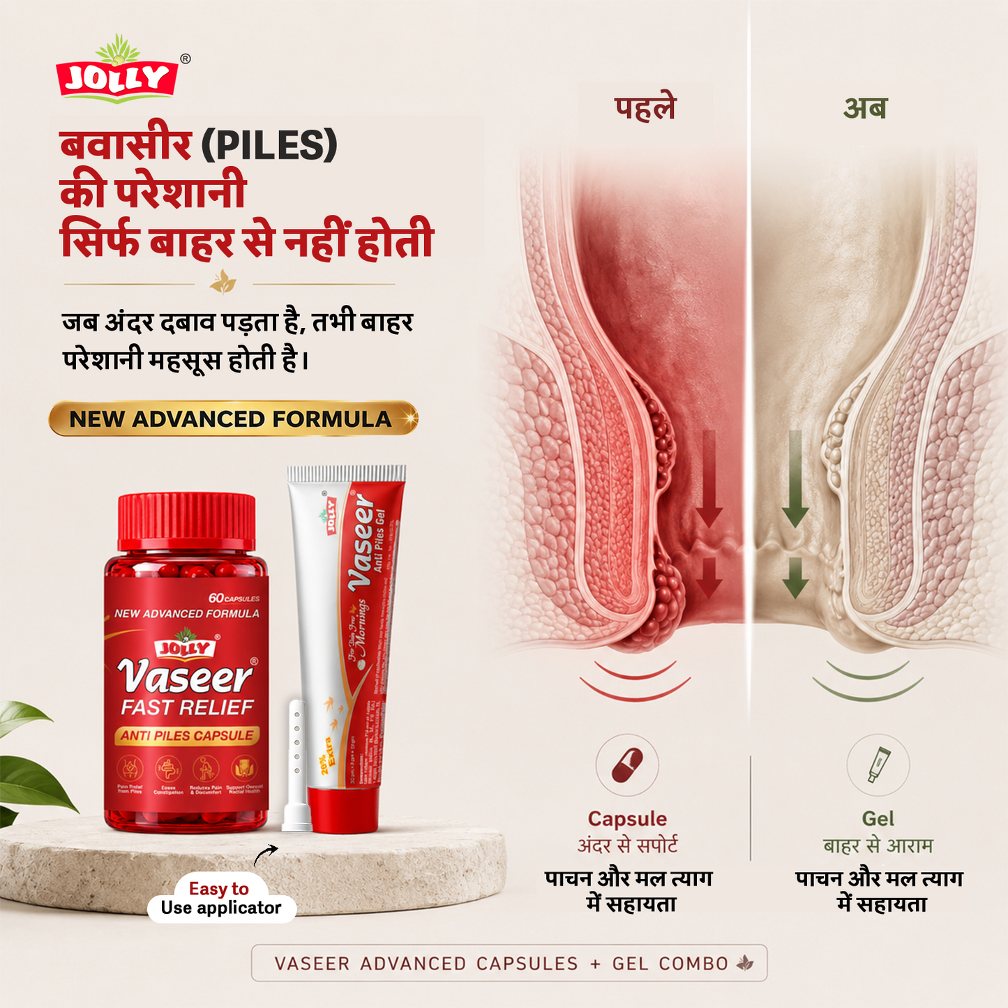 Advertisement for Jolly Vaseer Fast Relief Ayurvedic piles treatment  capsule and gel combo with before and after illustration.